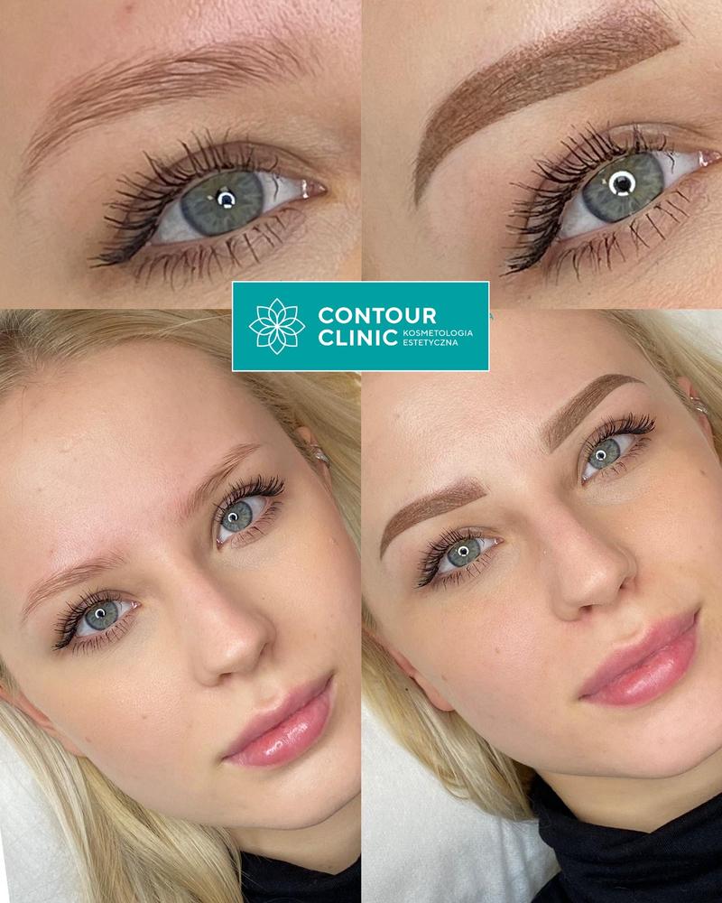 Czas gojenia makijażu