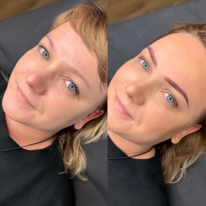 Czynniki wpływające na gojenie