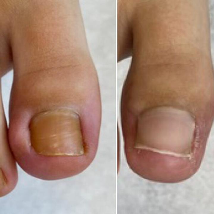 DIY przedłużanie paznokci