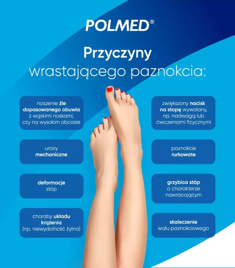 Domowe sposoby na paznokcie