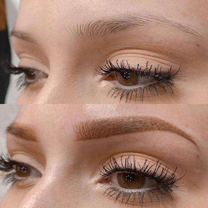 Pielęgnacja skóry po zabiegu