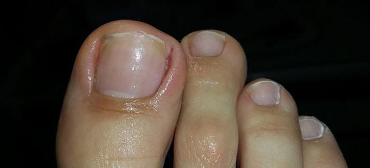 Zioła i naturalna pielęgnacja stóp