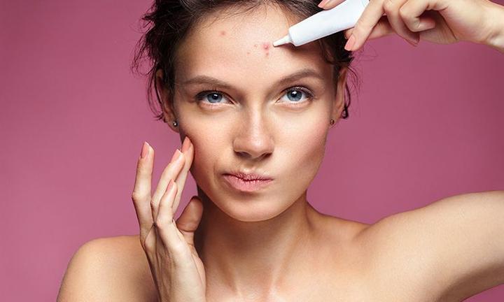 Naturalne sposoby na pryszcze