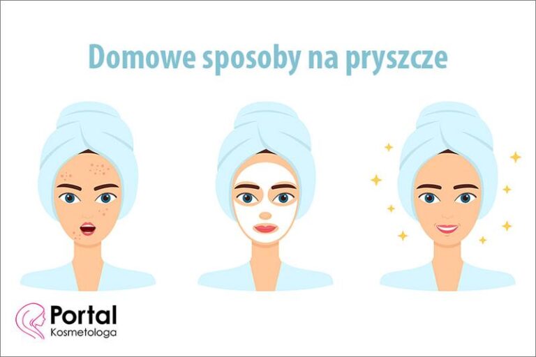 Naturalne sposoby na ukrycie pryszczy bez makijażu – sprawdź, jak to zrobić!