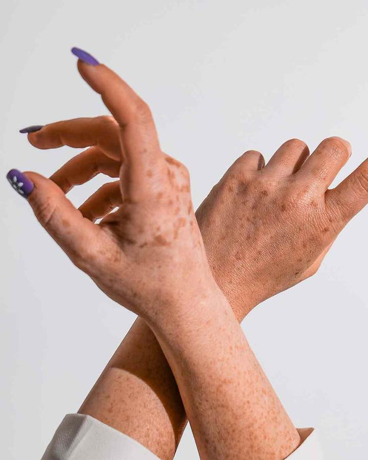 Środki chemiczne do usuwania plam