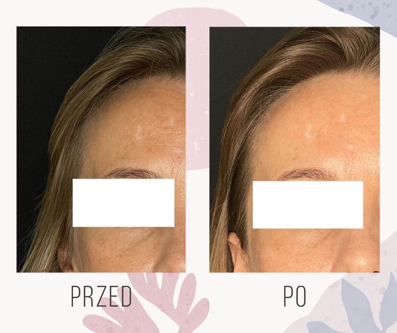 Suszenie i przechowywanie białych ubrań